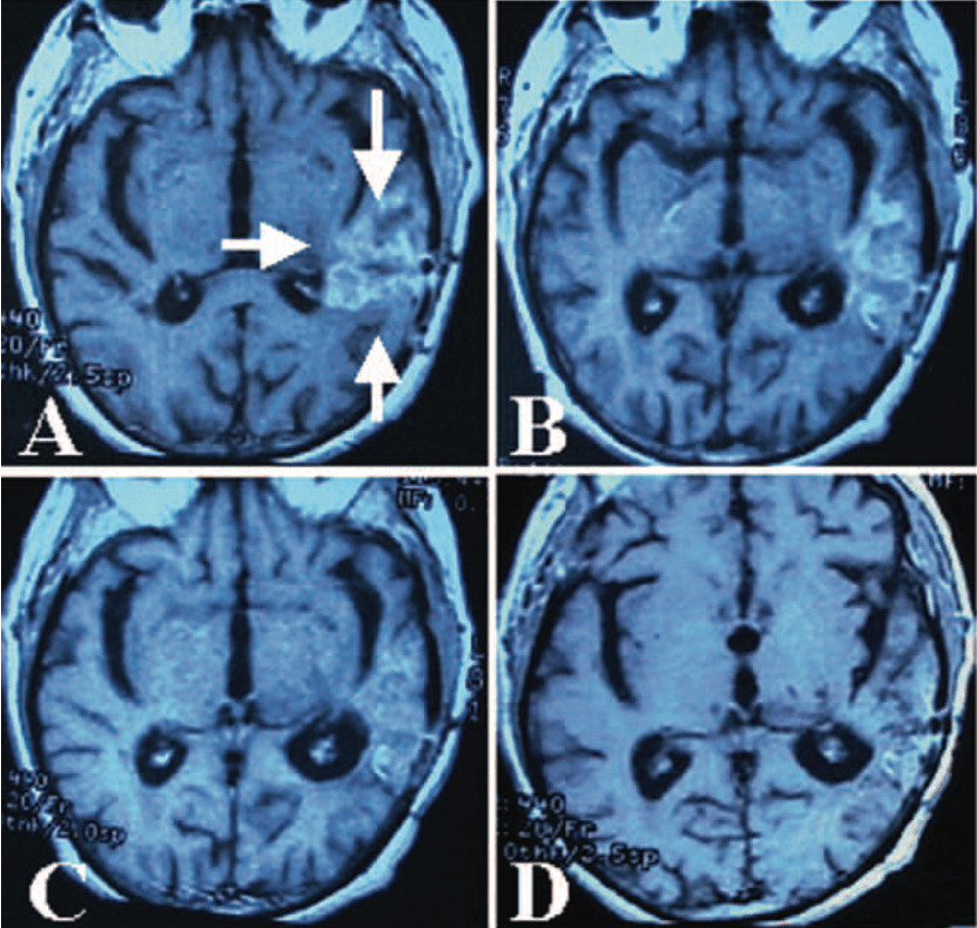 Fig 6 - Ciocca  - Cell Stress & Chaperones 2007